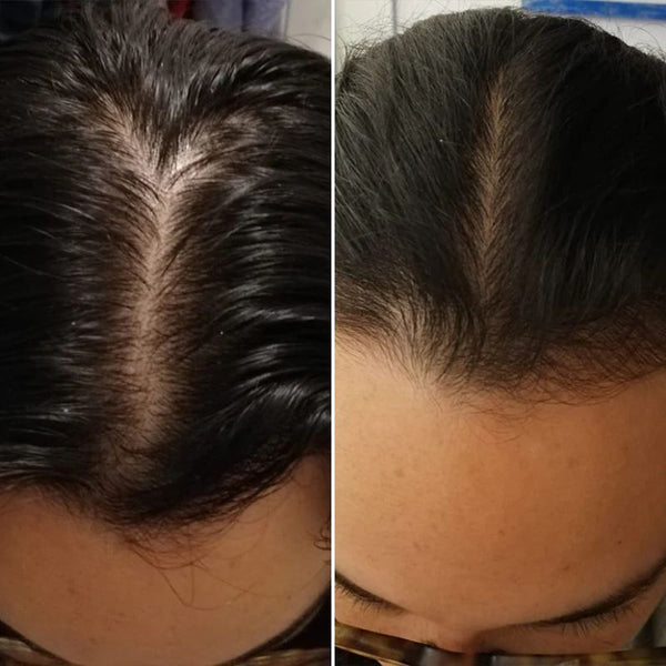 Valéria S, 32 años