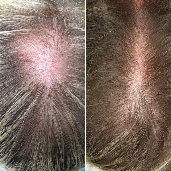 Maria José A, 55 años