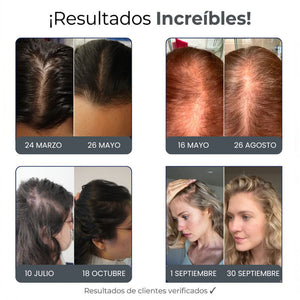 Cura de Micro-Infusión | Reparación & Crecimiento