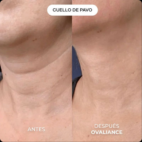 Kit de Micro-Infusión Antiedad