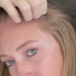 Cura de Micro-Infusión | Reparación & Crecimiento