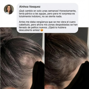 Cura de Micro-Infusión | Reparación & Crecimiento