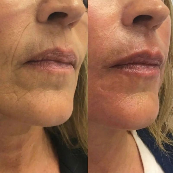 Carmen D. (51 años) – Compra verificada