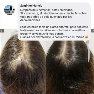 Cura de Micro-Infusión | Reparación & Crecimiento