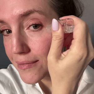 Kit de Micro-Infusión Antiedad